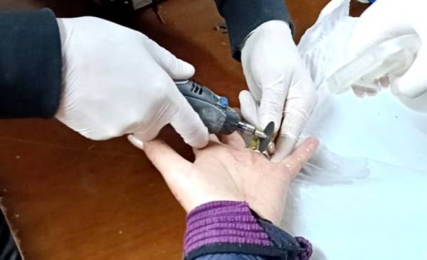 Bomberos Voluntarios asistieron a una vecina para retirarle un anillo trabado - Últimas Noticias: El Chubut