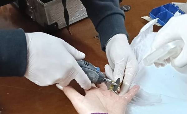 Bomberos asistieron a vecina en Rawson que tenía un anillo trabado - Últimas Noticias: El Chubut